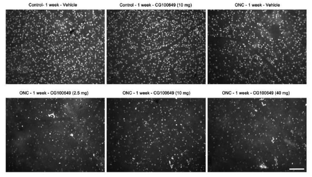 Effect of CG100649 on RGC loss at 1 week after optic nerve crush. Brn3a wholemount immunohistochemistry. High magnification showed representative images from the middle area of retinas at 1 week after optic nerve crush. ONC, optic nerve crush. Scale bar = 100 μm.