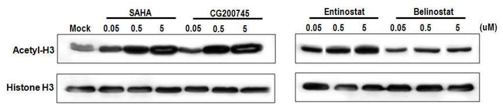 Y79 retinoblastoma 세포주에서 HDAC 저해에 의한 histone H3 아세틸화 western blotting 결과