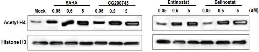 Y79 retinoblastoma 세포주에서 HDAC 저해에 의한 histone H4 아세틸화 western blotting 결과