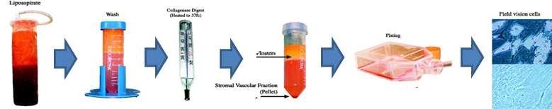 중간엽줄기세포 분리 배양 Procedure