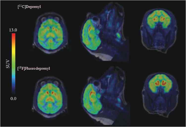 C-11 deprenyl과 F-18 fluorodeprenyl monkey 영상