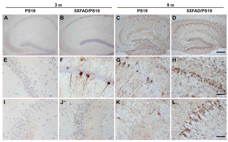 3개월, 9개월령의 타우 형질변환 마우스(PS19)와 트리플 형질변환 마우스(5XFAD/PS19)의 세포 사멸 관찰(해마의 CA1)