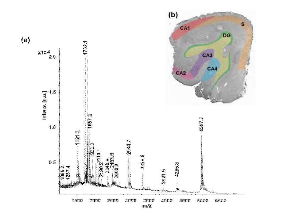 (a) (b)섹션으로부터 얻어진 MALDI mass spectrum. (b) 간질 환자의 hippocampus 절편.