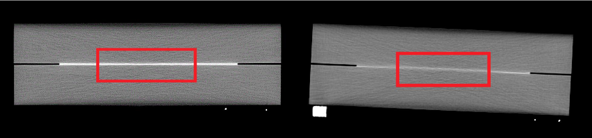 Aluminum plate image in transverse plane for parallel non-oversampling