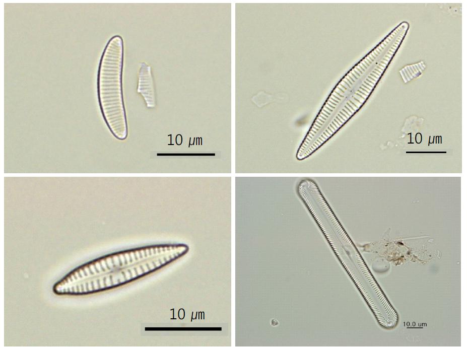 오대산 산지습지 미세조류 출현 종. A. Eunotia bilunaris, B. Gomphonema gracile, C. Gomphonema parvulum, D. Pinnularia macilenta.