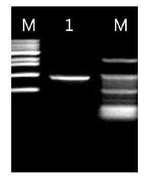 PCR product of the 18S rDNA amplified with the 143F and 145R primer set.