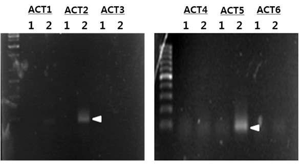 GeneFishing analysis in WSSV infected shrimps revealed multiple differentially expressed genes.