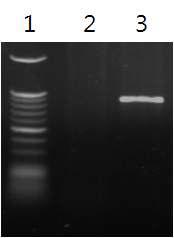 Detection of WSSV from dead shrimp after vaccination and WSSV challenge by using PCR.