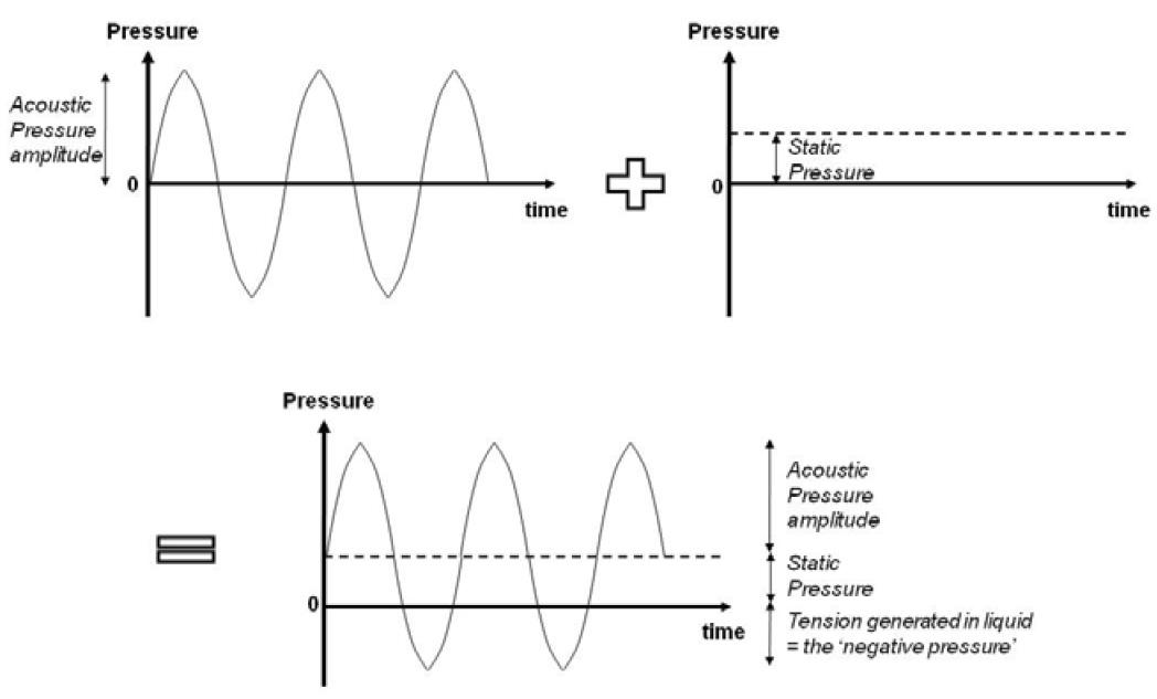 액상 매질에서의 음압의 형성