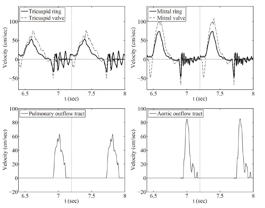 4개의 밸브를 통과하는 혈액의 속도에 대한 두 주기 동안의 결과 그래프