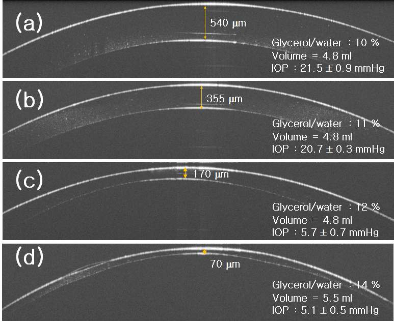 OCT topographic images of PDMS eyeball.