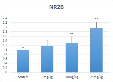 NR2B 의 발현양상