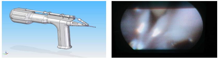 Appearance of new AVI for mouse and insertion image into trachea