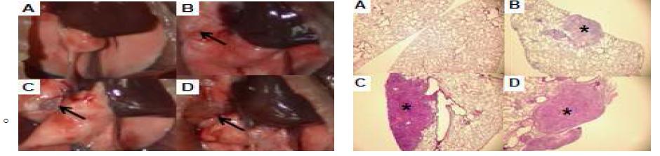 Gross and histopathological(x40) lesions after A549 cancer cells transplantation.