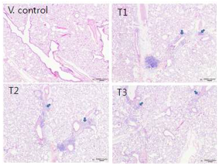 Histopathological examination of the lungs Gene Expression (H&E Staining)