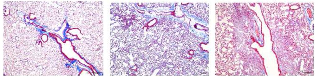 Hostopathological evaluation (Masson