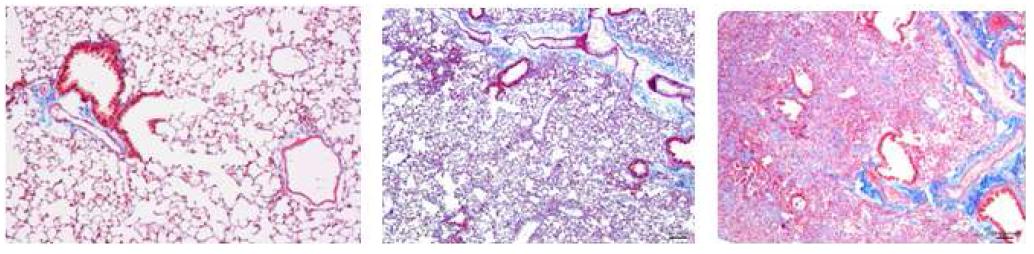 Hostopathological evaluation (Masson