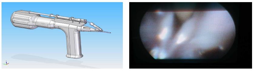 Appearance of new AVI for mouse and insertion image into trachea