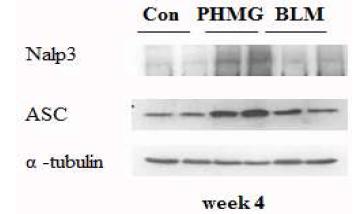 PHMG-P의 Inflammasome 관련도