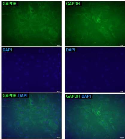 인간 유도만능 줄기세포 유래 간세포를 이용한 HCS 적합 분자 이미징 시스템 구축 – In situ hybridization