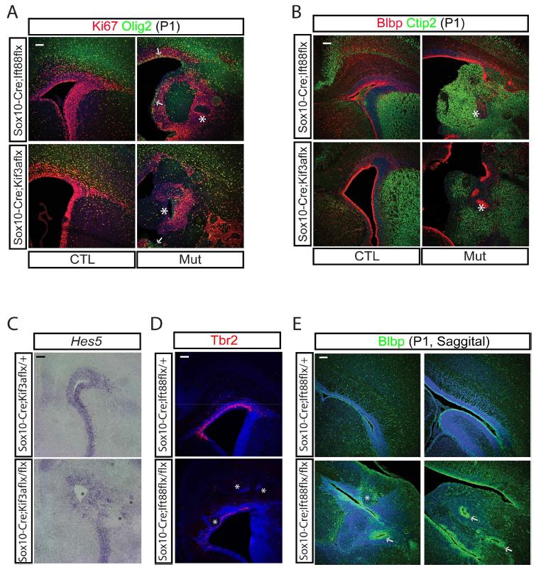 Primary cilia 이상 마우스의 CSF 이상에 의한 뇌발생 변화