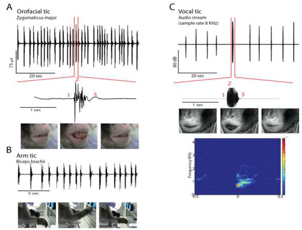 Behavioral effects in response to sensorimotor and limbic injections.