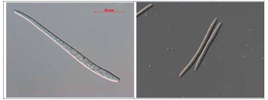 Cercospora(좌) 와 Pseudocercospora(우)의 포자