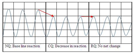 Hypothetical KNFS question sequence and respiration difference among NQ, CQ and RQ.