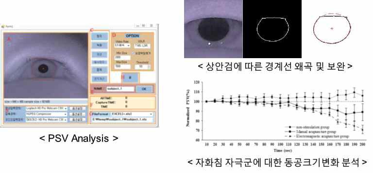 동공크기 변이 분석을 위한 전처리 과정 및 연구 수행 결과