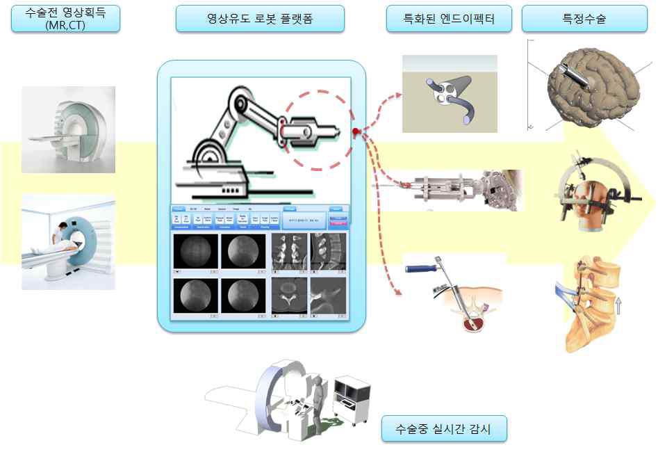 뇌신경외과 수술 시스템