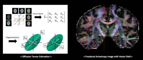 그림 4 확산텐서 영상을 전처리를 통한 고유 벡터 획득
