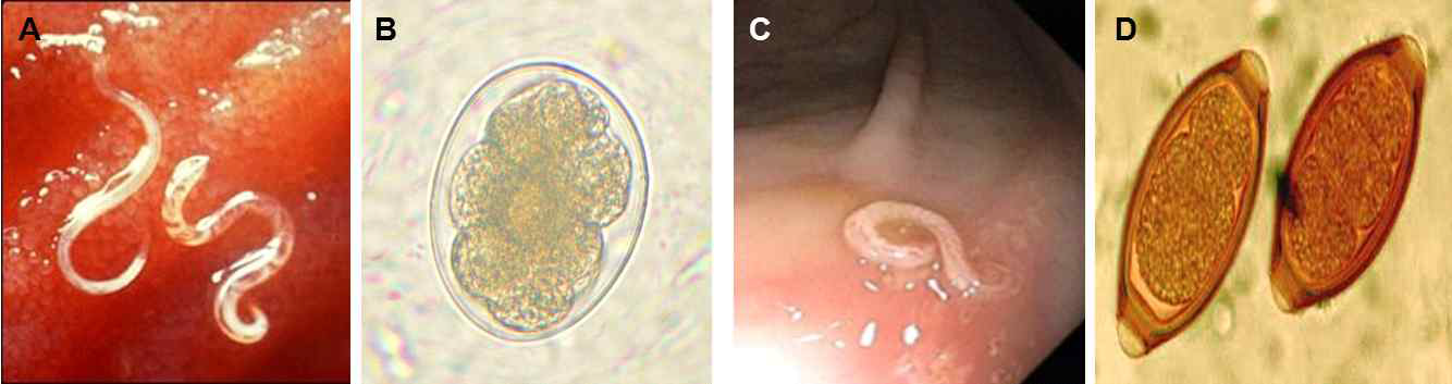 감염된 상태의 선충의 모습 및 충란의 형태