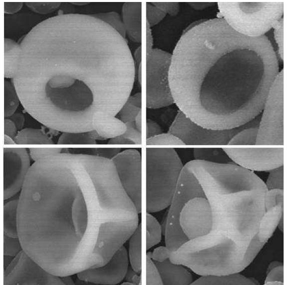 팟(Pot) 및 할로우(hollow)형을 갖는 아파타이트 분말의 주사전자 현미경 사진.