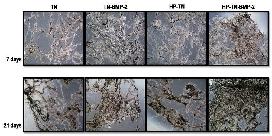 von Kossa staining을 이용한 PLA/gelatin 나노섬유/micro-porous 복합 지지체에서 osteoblast로 분화한 hMSCs가 분비하는 미네랄 분석