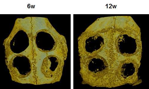 Calvaria defect를 통한 동물모델의 골 재생능 평가. PCL(왼쪽 위), PCL-AAc(오른쪽 위), PCL-HAp(왼쪽 아래), PCL-HAp/Sim(오른쪽 아래)