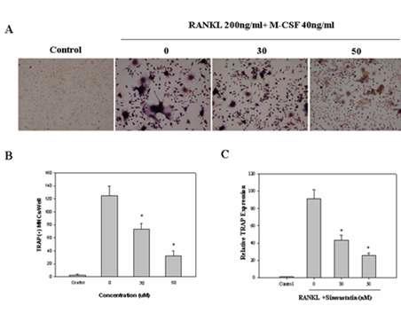 Trap staining 및 Real-time PCR를 통한 bone marrow-derived macrophage (BMM) 세포에서 simvastatin을 통한 골재생능 확인