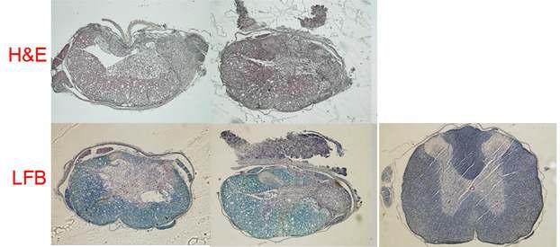 척추 손상 동물에서의 이식 14일 후 조직 염색학적 평가 (A) 척추 손상 군, (B) 신경 줄기세포 이식한 약물방출 유도체 이식 군, (C) 정상 조직