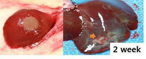 간 모델에서 재생 유도체 평가를 위한 이식 모습