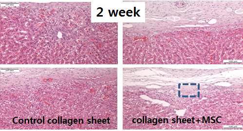 콜라겐 지지체의 간 조직에서의 재생능 평가