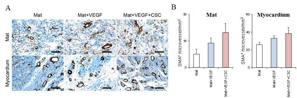 혈관 재생능 평가 (A) SMA 염색, (B) 혈관 밀도 측정