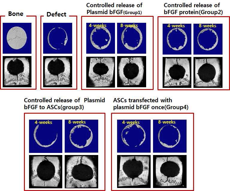 골 손상 모델에 이식 후 4, 8주 후의 2-D CT 분석