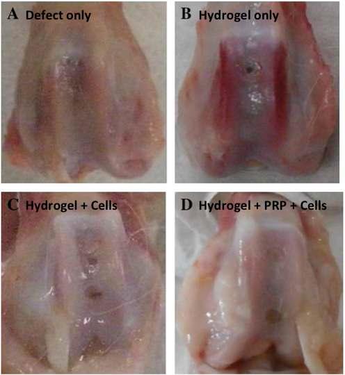 GPT/PRP 하이드로젤을 이용한 연골 재생능 평가.