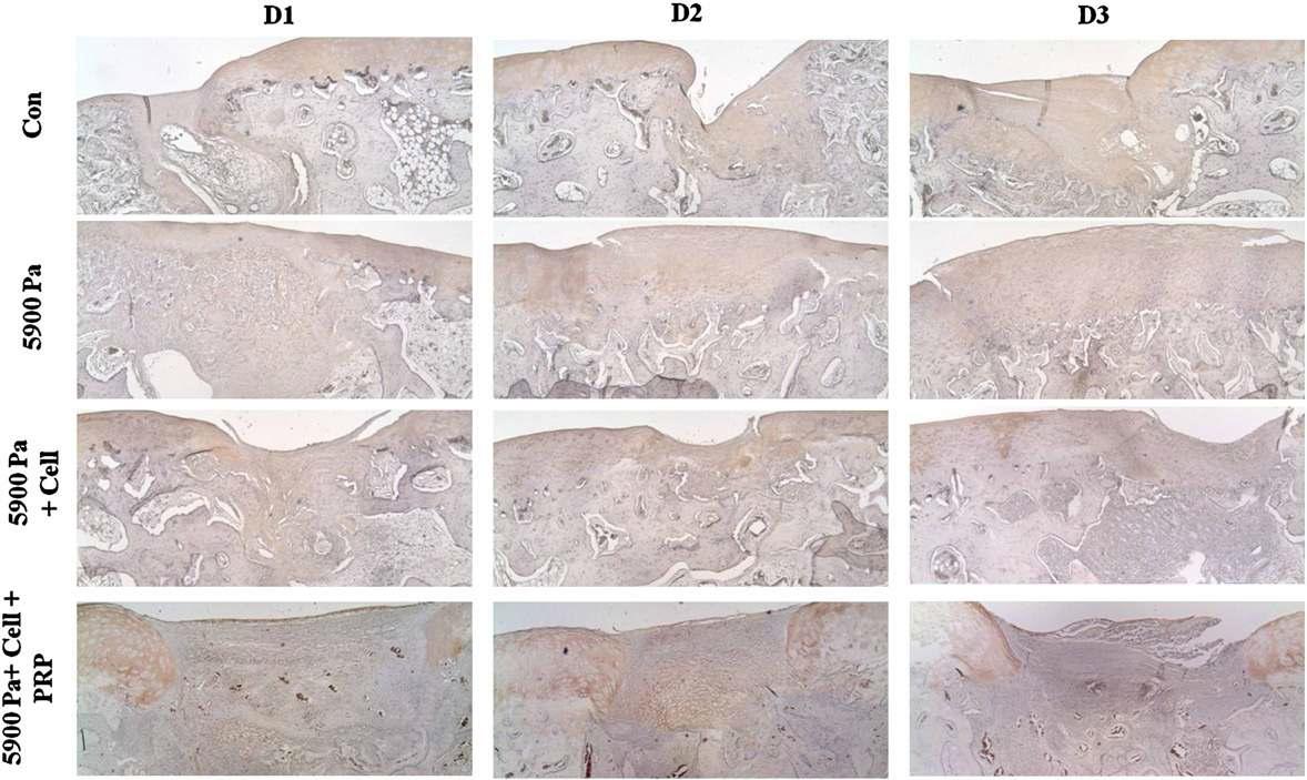 Collagen type II 면역 염색을 통한 연골 재생능 평가.