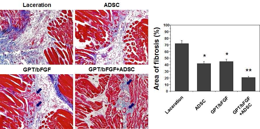 성장인자 및 줄기세포가 담지된 GPT 하이드로젤의 근섬유증 증식 비교