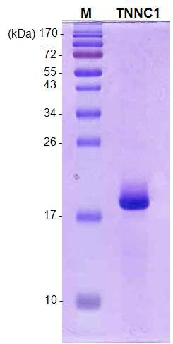 최종 정제된 troponin C (단백질 농도 1.4mg/ml) lane M; protein marker, lane TNNC1; purified troponin C