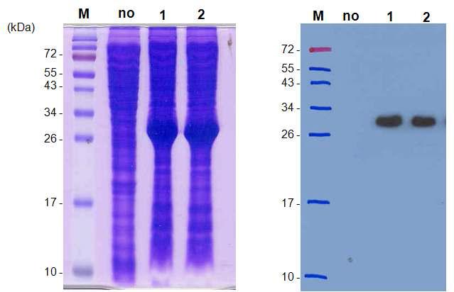 Troponin I의 단백질 발현 (좌) SDS-PAGE를 이용한 발현 결과 확인. (우) western blot을 이용한 발현 확인 Lane M; protein marker, lane no; soluBL21 cell extract (no induction), lane 1; total cell, lane 2; cell extract