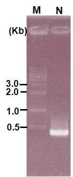 PCR을 이용해 증폭된 BNP 유전자. Lane M; 1Kbp DNA Ladder Marker, lane N; BNP gene