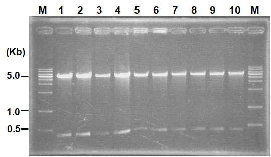 BNP의 클로닝 확인을 위한 제한효소 처리. Lane M; 1Kbp DNA Ladder Marker, lane 1 -10; NdeI과 XhoI 처리된 pET21NPPB(BNP gene)
