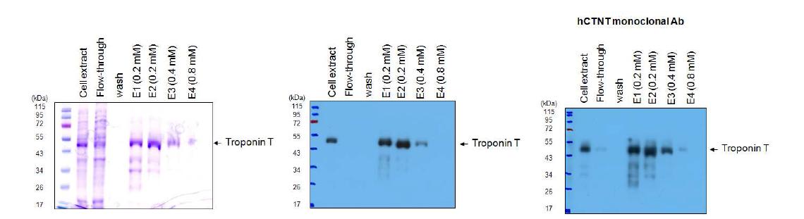 1mM IPTG로 induction된 Troponin T의 Ni-NTA bead binding과 fractionation 확인