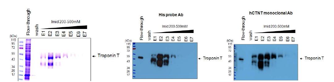 0.1mM IPTG로 induction된 Troponin T의 Ni-NTA bead binding과 fractionation확인